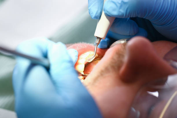 Best Emergency Treatment for Jaw Pain or Injury in Lake Shore, MD